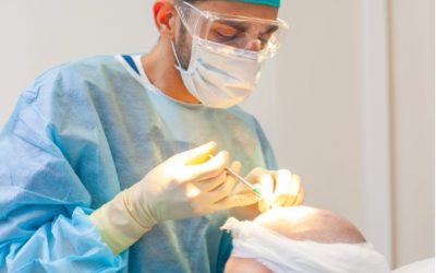 Transplantace vlasů v létě vs. v zimě: Kdy je nejlepší termín pro nový začátek?