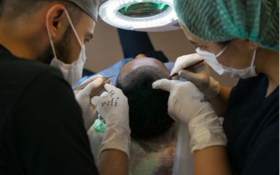 Dárcovská oblast po transplantaci vlasů: jak se hojí a dorostou v ní vlasy?